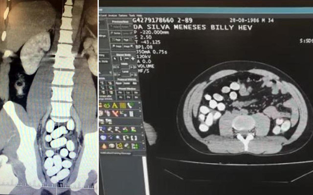 İstanbul Havalimanı'nda yakalandılar hepsi midelerinden çıktı! Değeri 3 milyon lira - Resim: 0