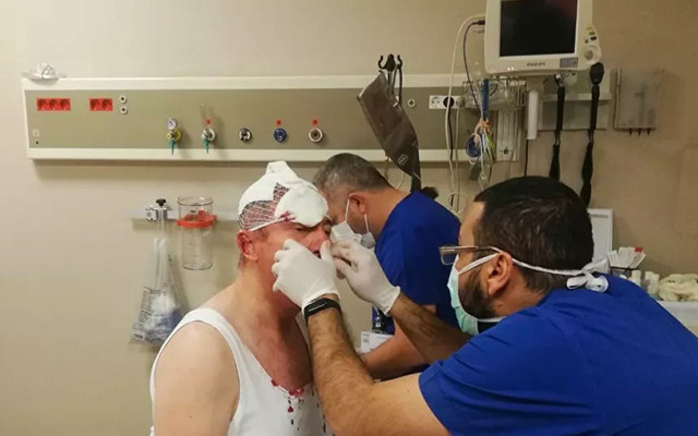 Gelecek Partisi Genel Başkan Yardımcısı Selçuk Özdağ'a silahlı saldırı düzenlendi - Resim: 1