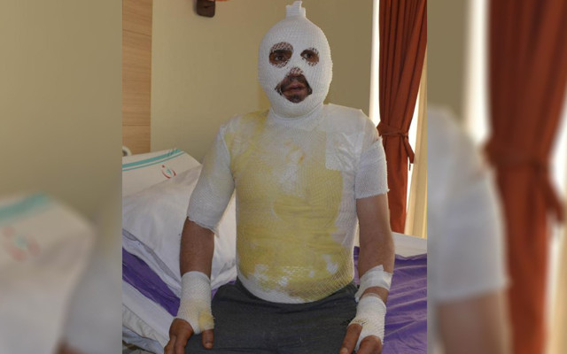 Iğdır'da taciz iddiası ortalığı karıştırdı! Akrabaları tarafından yakıldığını söylüyor - Resim: 0