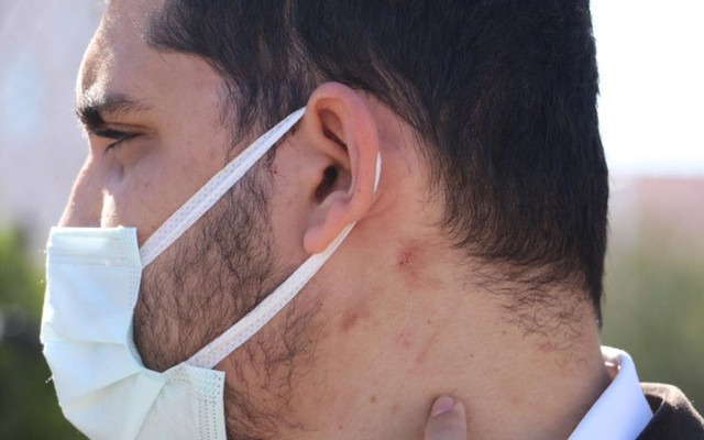 Antalya'da yüzde 90 engelli adama öldüresiye dayak! Hastanede 'vurmayın' diye sayıklıyor - Resim: 2