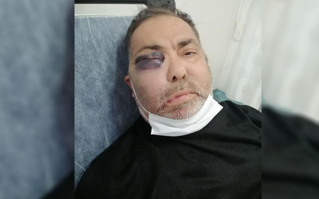 Antalya'da yüzde 90 engelli adama öldüresiye dayak! Hastanede 'vurmayın' diye sayıklıyor - Resim: 1