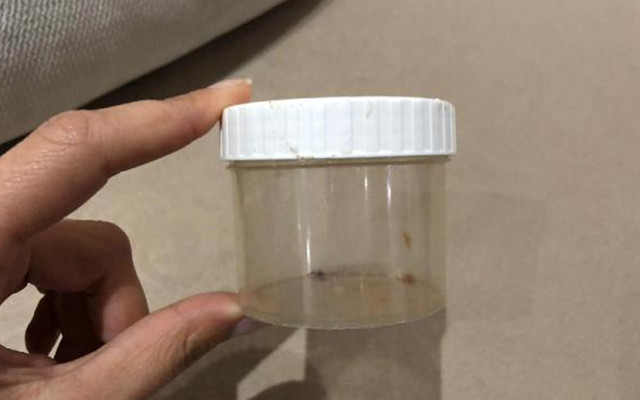 Sahte doktorun 'bitkisel ilaç' vurgunu! 180 bin lira dolandırdı 'denize düştük yılana sarıldık' - Resim: 0