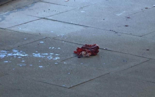 Üsküdar'da kısıtlama saatinde esnafa silahlı saldırı: Bacak ve kasık bölgesinden yaralandı - Resim: 1