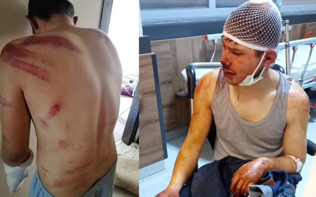 Afyonkarahisar'da alacağını isteyen çırağa kabusu yaşatmışlardı! Silah sayılması istendi - Resim: 0