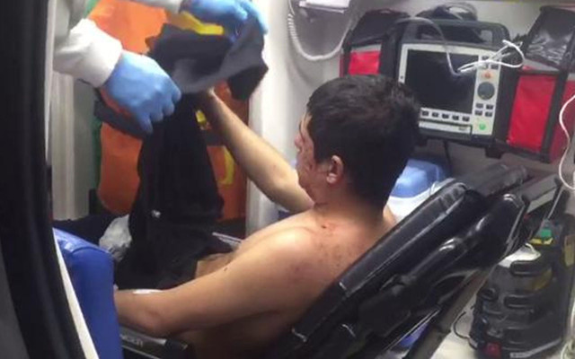 Antalya'da pencereden içeriye bakma kavgasında 3 kişi yaralandı - Resim: 0