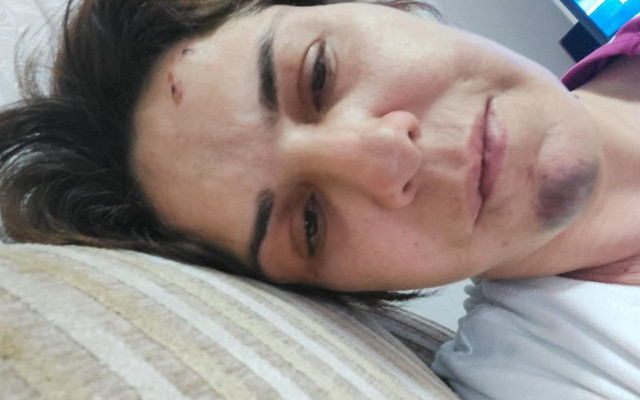 İzmir'de işkenceci dini nikahlı kocanın 'son bir kez sarılayım' oyunu - Resim: 2