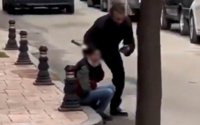 Samsun'da çıkan kavgada gençlerden birinin kafasına bıçak saplandı - Resim: 0