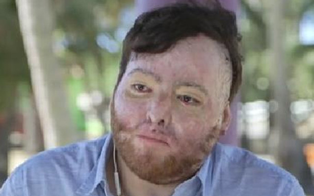 ABD'de 7 ay hastanede tedavi gören kişiden 1.7 milyon dolar yatak ve tedavi ücreti istendi - Resim: 0