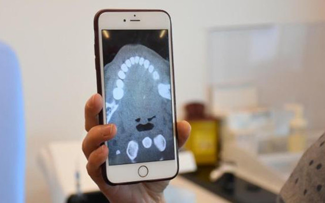 İzmir'de kokoreç yerken hayatının şokunu yaşadı! Boğazı ağrıyor sandı gerçek başka çıktı - Resim: 0