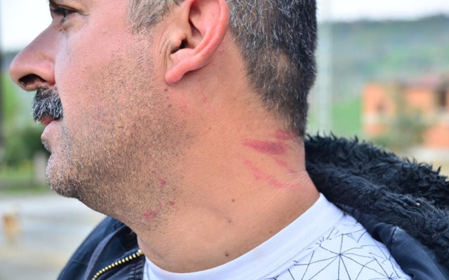 Ordu'da doktor darbedildi denmişti! 'Asıl mağdur benim' deyip doktoru suçladı - Resim: 0