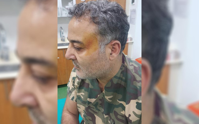 Ordu'da doktor darbedildi denmişti! 'Asıl mağdur benim' deyip doktoru suçladı - Resim: 2