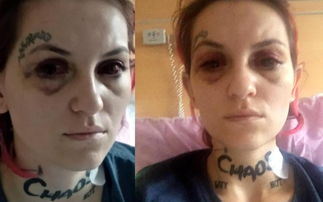 Zonguldak'ta eski sevgilisini 9 yerinden bıçaklayan şahsa 17 yıl ceza talebi - Resim: 0