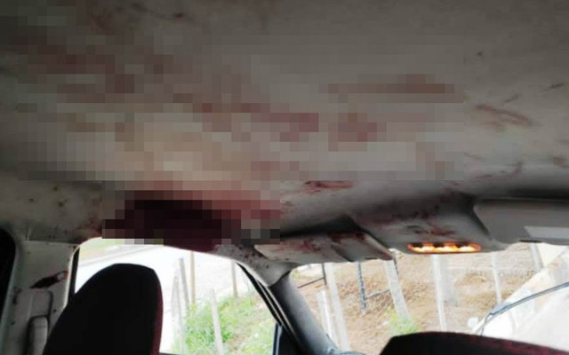 Diyarbakır'da muayene olup çıktığı hastaneye cansız bedeni geldi - Resim: 0