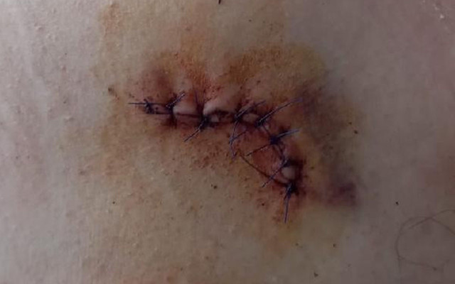 Sıra tartışmasında sivil 3 jandarmayı yaraladı! Küçükçekmece'de market canavarı serbest - Resim: 3