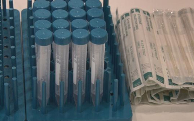 10 saniyede Covid-19 testi! 4 Türk bilim insanı geliştirdi - Resim: 2