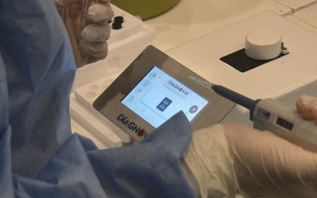 10 saniyede Covid-19 testi! 4 Türk bilim insanı geliştirdi - Resim: 0