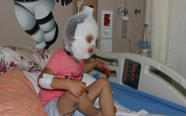 Ağrı'da kardeşiyle banyoda oyun oynamak istemişti! 4 yaşındaki Ayfer feci şekilde yandı - Resim: 0