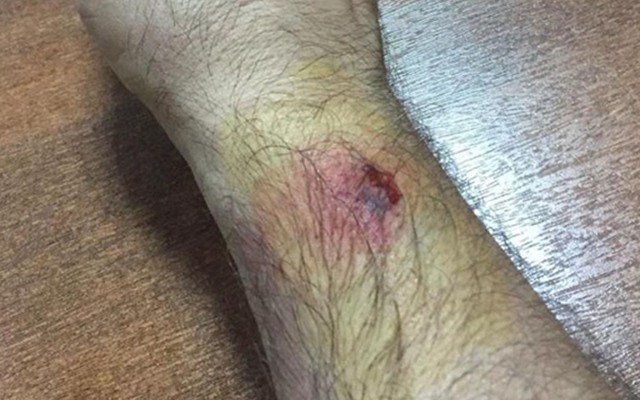 Adana'da baskında kumar parasını kaptırınca komiserin kolunu ısırdı - Resim: 0