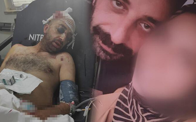 Bursa'da kız arkadaşının ailesi önce otomobille çarptı sonra yoğun bakımlık etti - Resim: 1