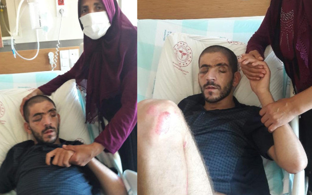 Feci kazada hayatta kaldı ama görme yetisini kaybetti tek isteği kızını görebilmek - Resim: 1