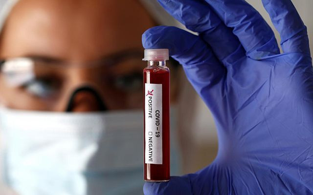 Dünya genelinde koronavirüs vaka sayısı 700 bini geçti - Resim: 3