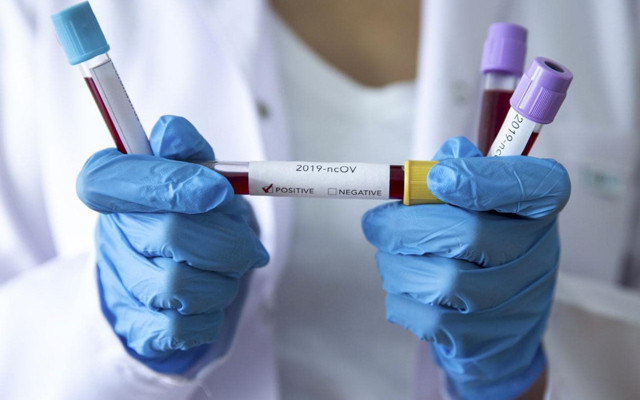 İstanbul, Ankara, İzmir, Kocaeli’de en çok korona olan ilçeler açıklandı