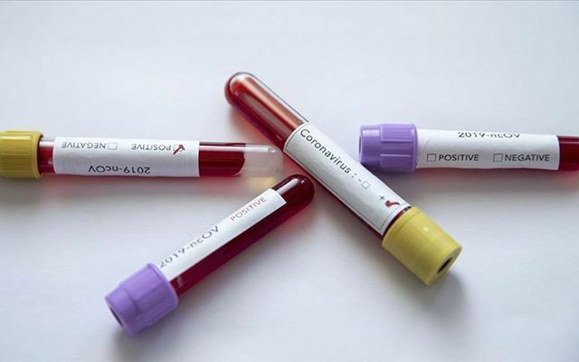 Çin'de koronavirüs aşısı için klinik denemelerde ikinci aşamaya geçildi - Resim: 1