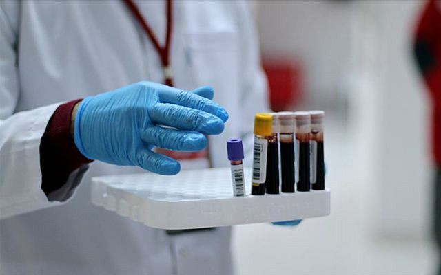 Plazma tedavisi uygulanan koronavirüs hastasının testi negatife döndü - Resim: 2