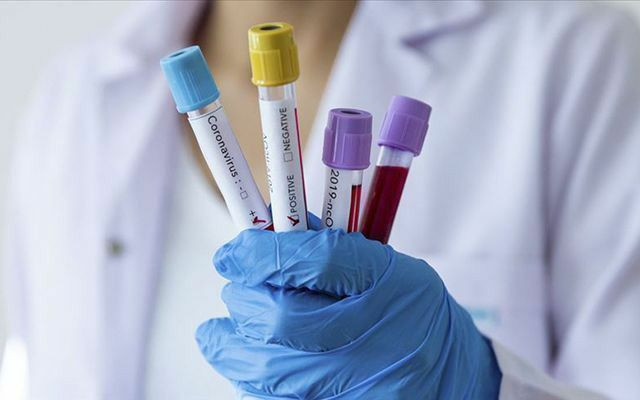 İngiltere’de negatif çıkan testlerin yüzde 30’u yanlış olabilir - Resim: 4