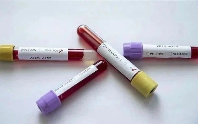 Dünya genelinde koronavirüs vaka sayısı 26 milyonu aştı - Resim: 2