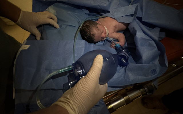 Katliam kan dondurmaya devam ediyor! Saldırıda ölen hamile kadının bebeği kurtarıldı