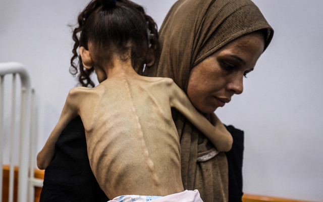 25 kilodan 10 kiloya düştü! Gazzeli Meryem'in son haline yürek dayanmıyor