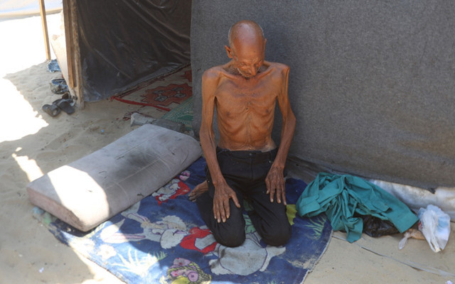 Gazzeli müezzini görenler şoke oluyor 70 kilogramdan bakın kaç kilograma düştü