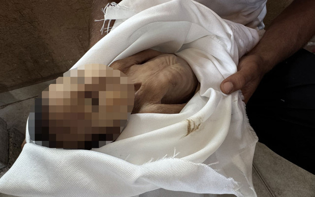 Gazze'de 5 aylık bir bebek açlıktan öldü! Kıyamet kopmalıydı ama dünya suskun