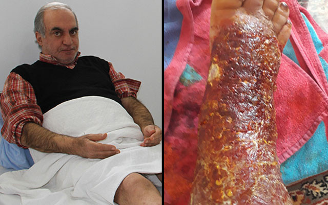 Yaralar içindeki bacağı kesilmek üzereydi! Bu yöntemle tamamen iyileşti - Resim: 1