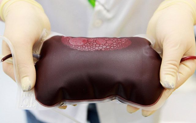 Gençlerin kanını alıp yaşlılara satıyor! Kanın fiyatı ise şoke etti - Resim: 4