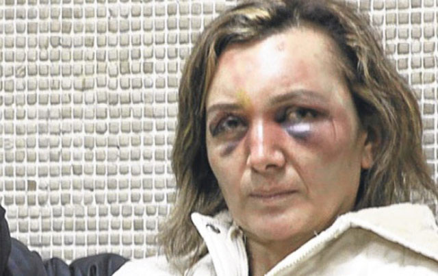 Ünlüler kadınlar günü için öldü - Resim: 2