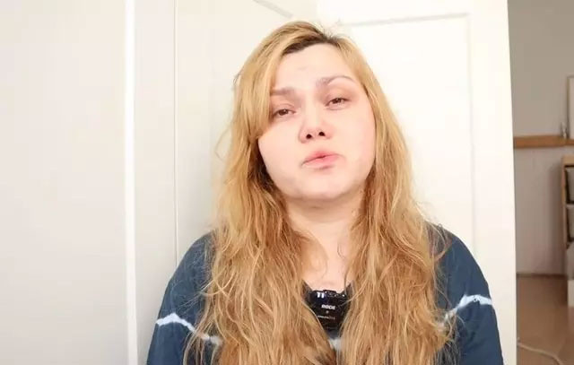 Öldürülmek istenen Youtube fenomeni Merve Veziroğlu: "58 kesik vardı, gözümü açtığımda kanlar fışkırıyordu" - Resim: 1