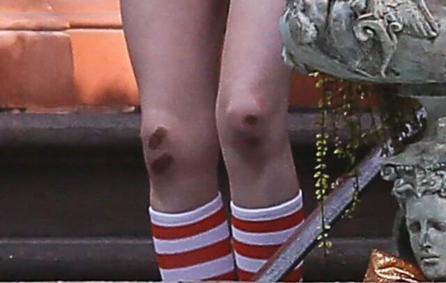 Dünyaca ünlü yıldız içler acısı halde şiddet mi gördü - Resim: 3