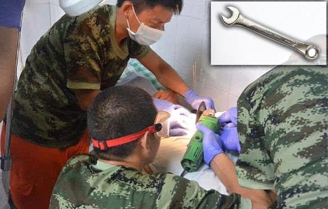 Cinsel organını yıldız anahtarına sıkıştırdı itfaiye seferber oldu - Resim: 2