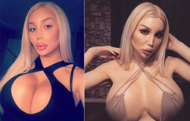 Şişme kadına benzemek için binlerce dolar harcadı! - Resim: 3