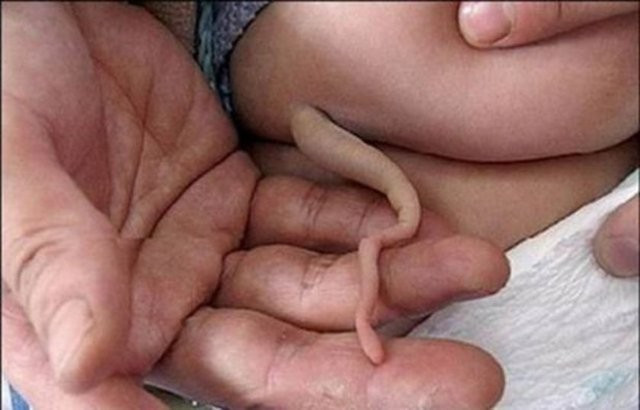 Onlar kuyruklarıyla doğdular! Montaj değil tamamen gerçek - Resim: 2