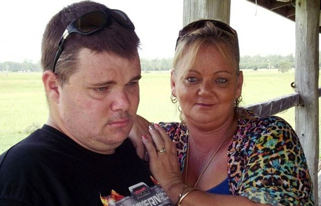 Testisleri karpuz büyüklüğünde tam 5 buçuk kilo! - Resim: 3