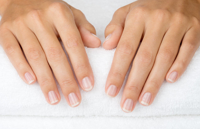 Tırnaklarda beyaz lekeler neden olur nasıl geçer? Bu besinleri tüketin etkiyi görün! - Resim: 0