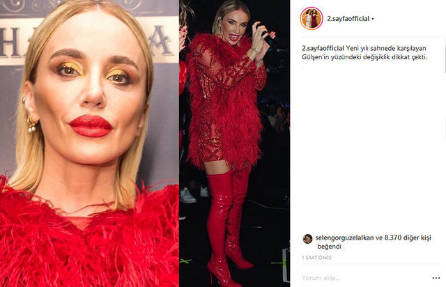 Şarkıcı Gülşen’in son halini gören inanamadı - Resim: 1