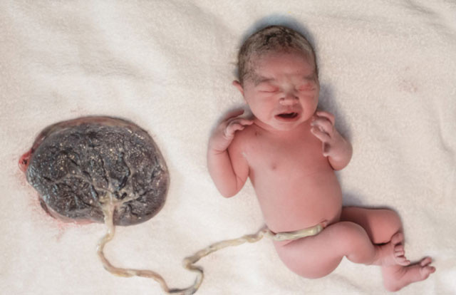  Hilary Duff'tan iğrenç itiraf bebeğinin plasentasını içti - Resim: 4