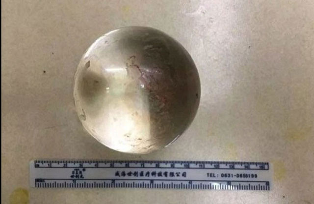 Eğlence için anüsüne öyle bir şey soktu ki hastanelik oldu! - Resim: 2