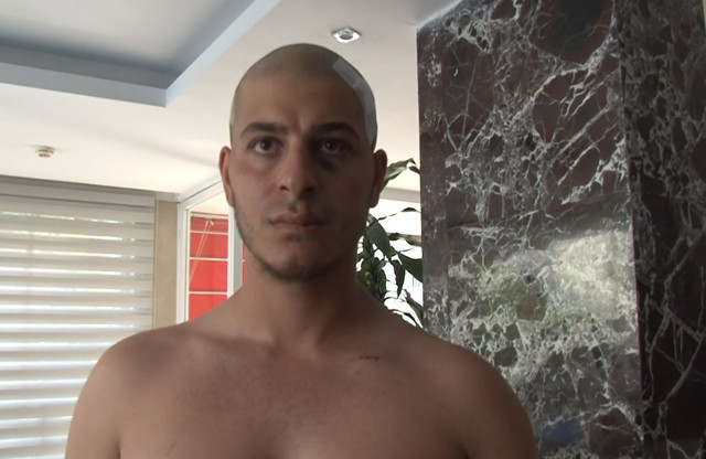 6 kişi tarafından sopalarla ve demir çubukla dövüldü! 'Ahlaksız teklif' iddiasına yanıt - Resim: 0