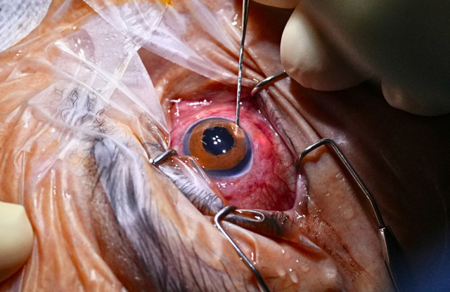 Banyoda düşen kadının hayatı altüst oldu! Kararan gözüne göz dövmesi ışık oldu - Resim: 0