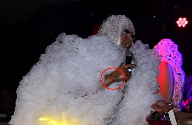 Ağır hastalık geçirdi elleri mosmor oldu Bülent Ersoy son haliyle herkesi korkuttu - Resim: 2